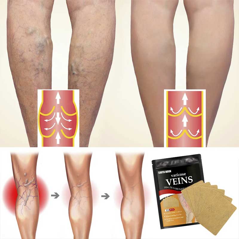 PARCHES PARA VARICES 12 unidades
