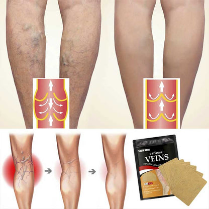 PARCHES PARA VARICES 12 unidades