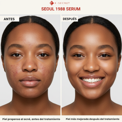 Retinal Seoul 1988®